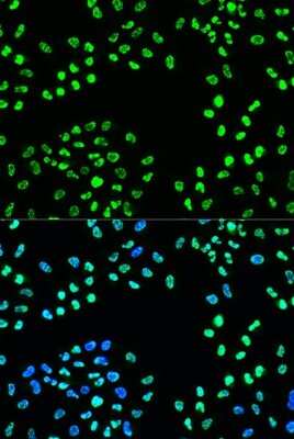 Immunocytochemistry/ Immunofluorescence: ATR [p Ser428] Antibody - Azide and BSA Free [NBP3-05447]